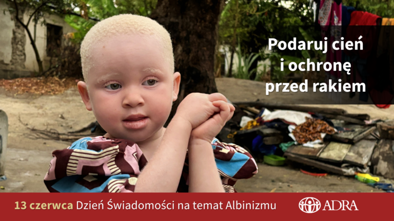 13 czerwca Międzynarodowy Dzień Świadomości na temat Albinizmu